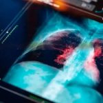 El IMSS detalla que solamente en 2022 gastó 26 millones de pesos en contratos para la subrogación de servicios para laboratorios de oncopatología.