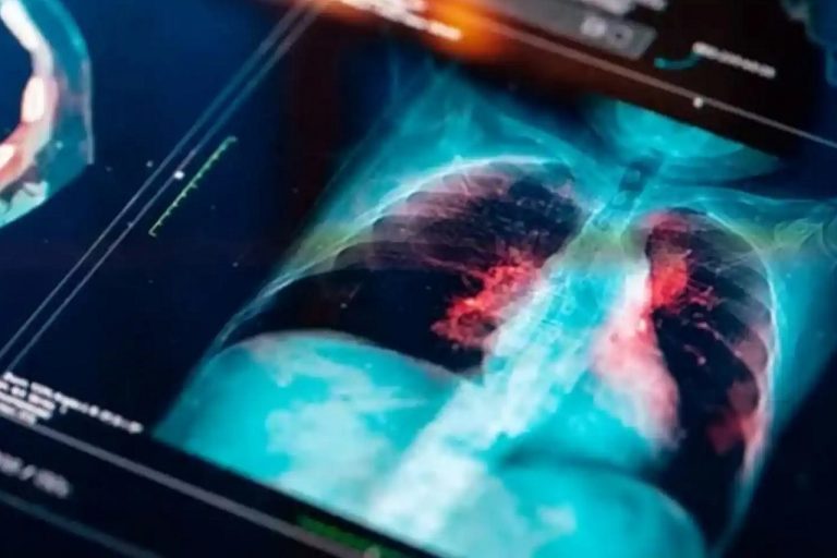 El IMSS detalla que solamente en 2022 gastó 26 millones de pesos en contratos para la subrogación de servicios para laboratorios de oncopatología.